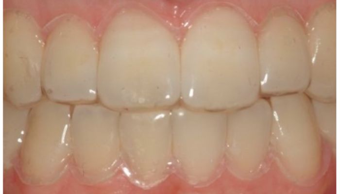 Los dos caminos hacia la sonrisa que deseas