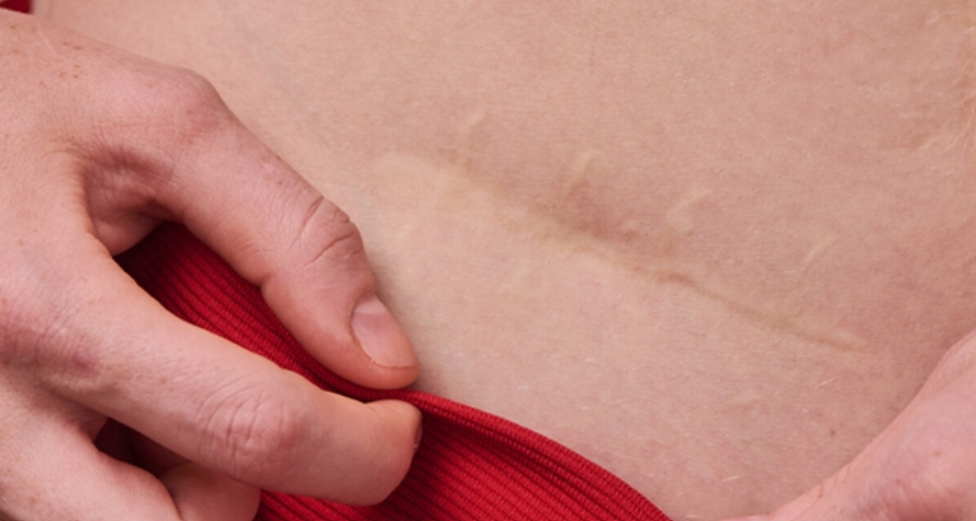 Cirugía reconstructiva: restaurar la función y mejorar la calidad de vida